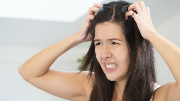 health tips: Are you suffering from dandruff problem? then try these tips!!