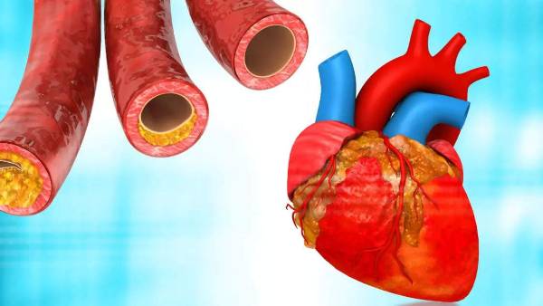 గుండెను పాడు చేసే మరో శత్రువు చెక్కెర .. తినటం మానెయ్యండి