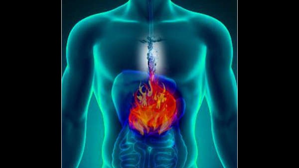 చిన్న చిన్న చిట్కాలతో కడుపులో మంటకు చెక్ పెట్టండి చిన్న చిన్న చిట్కాలతో కడుపులో మంటకు చెక్ పెట్టండి