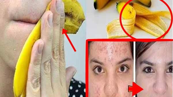 చలికాలం చర్మం పొడిబారే సమస్య నుండి అరటిపండుతో చెక్