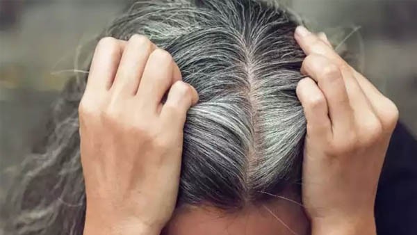 జుట్టు తెల్లబడుతుంది