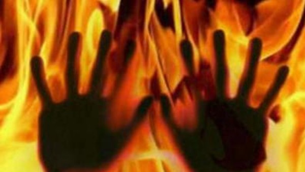 సార్ కు మంటలు వ్యాపించి ?