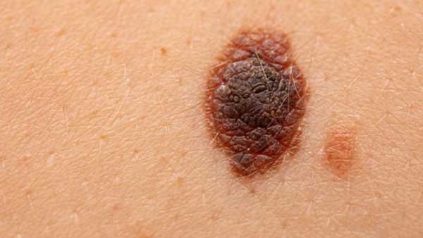 ఎక్కడుంటే మంచిది