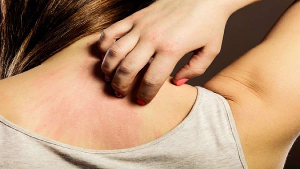 చర్మ వ్యాధులు