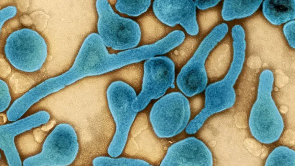 రక్తనాళాలు చిట్లి..