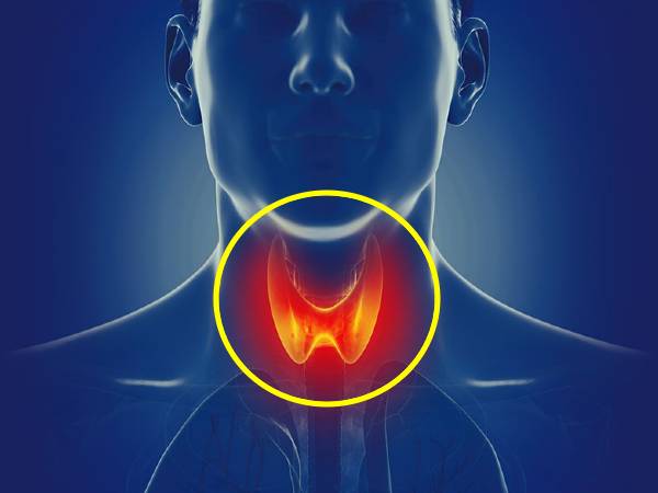 థైరాయిడ్