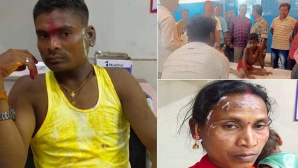 Ex-girlfriend arrested for acid attack on groom on wedding day in Chhattisgarh.
