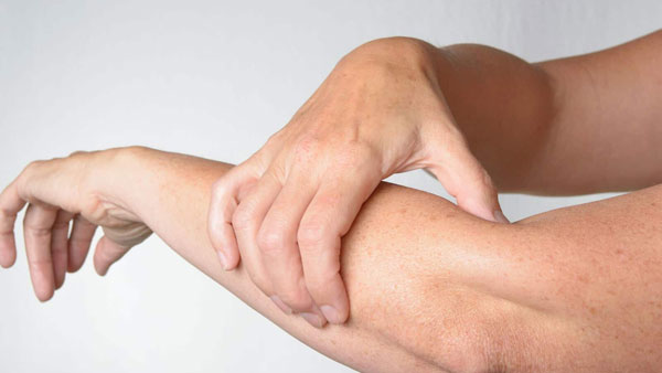 alcohol allergy positive case in hyderabad