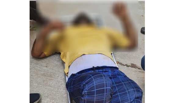 A delivery boy seriously injured in dog attack at Manikonda, Hyderabad.