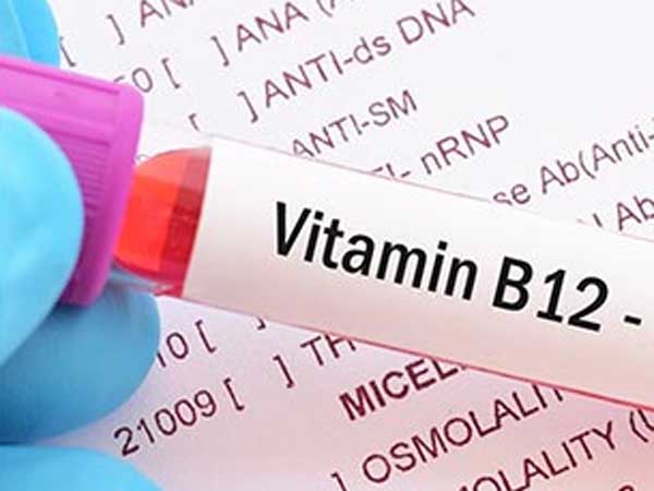 health tips: Vitamin B12 deficiency? Take this diet if you have these symptoms!!
