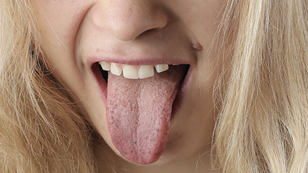 Do people with black spots on their tongues say anything becomes true?