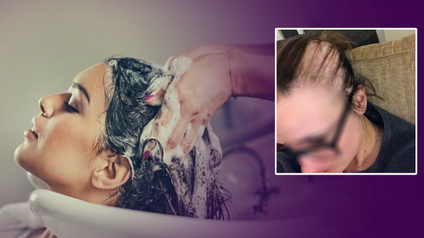 awomanlostherhair1 awomanlostherhair1