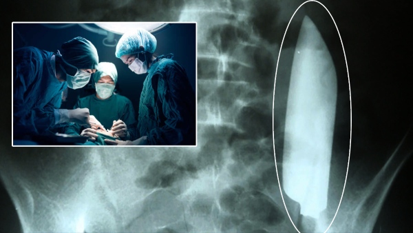 A young man who has been living hell with a knife in his stomach for five years.