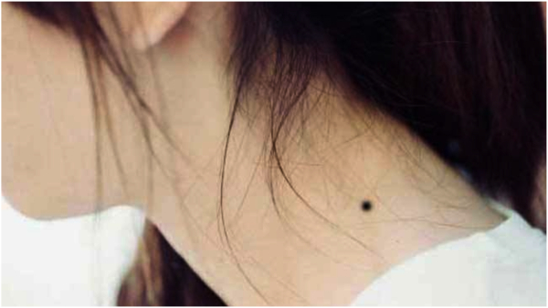 If you have moles on these parts of your body, you will have a lot of money!!