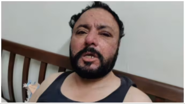 NRI attacked by pub bouncers in Gurugram NRI attacked by pub bouncers in Gurugram