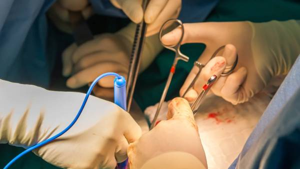 A government hospital employee who was under the influence of alcohol died after dialysis of a woman