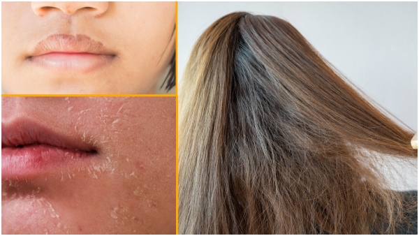 Four oils in navel for dry skin, dry hair, dry lips and eye sight!!