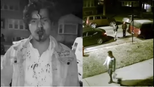 Hyderabad student brutally attacked by four robbers in Chicago, America