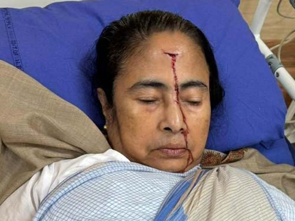 West bengal CM Mamata Banerjee suffers major injury in accident TMC