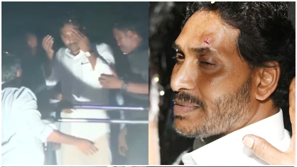 TDP and nara lokesh targets jagan bandage removal episode TDP and nara lokesh targets jagan bandage removal episode