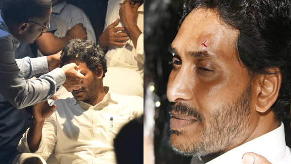 YSRCP Suspected air gun used for attack on YS Jagan in latest incident at Vijayawada