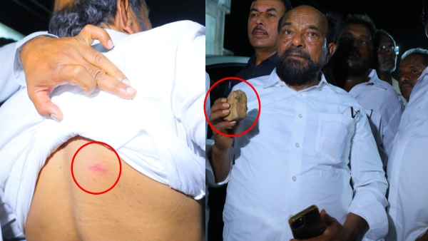 Stone Attack on YSRCP Rajya Sabha MP R Krishnaiah