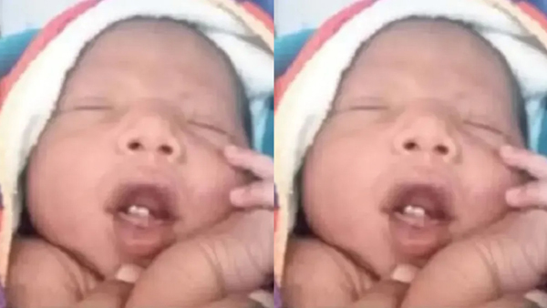 A strange incident in Jharkhand A baby born with teeth in its mouth