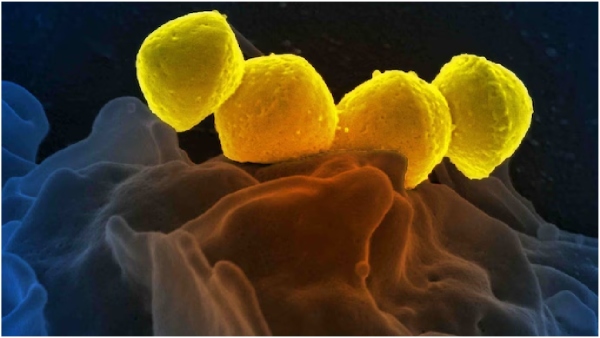 Streptococcal toxic shock syndrome bacteria spreading in Japan