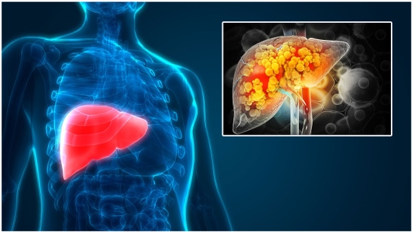 Eat these for a healthy liver