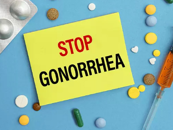 Symptoms of gonorrhea that spreads rapidly from one person to another