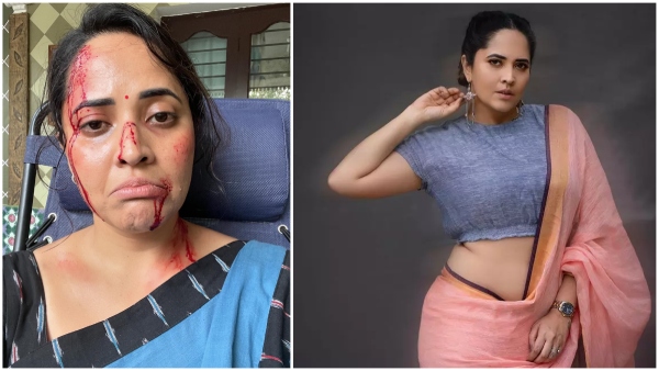 Anasuya is bleeding with severe injuries all over her face Fans in shock