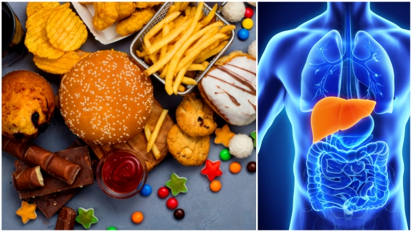 These fried and processed foods are more dangerous to liver than alcohol