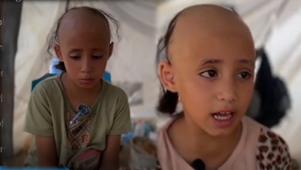 The Harrowing Impact of War 8-Year-Old Palestinian Girls Trauma Leads to Hair Loss