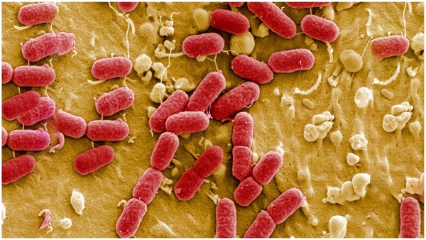 Another looming danger superbugs kills 4 crore people worldwide by 2050