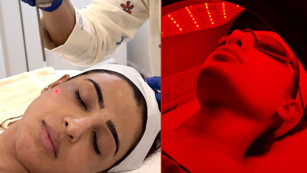 Samantha has taken skin treatment