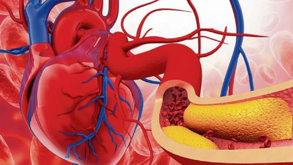Best Indian foods to reduce bad Cholesterol