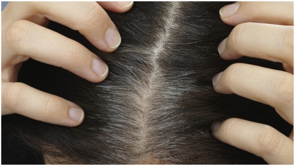 health Tips to turn white hair black
