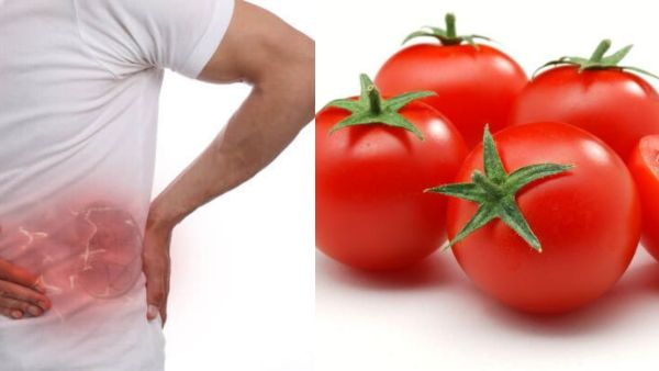 Do you get kidney stones if you eat too many tomatoes Do you get kidney stones if you eat too many tomatoes
