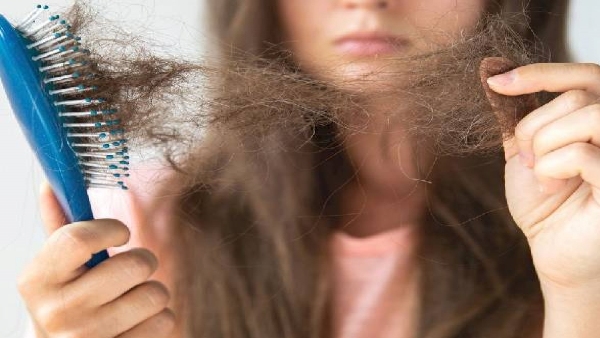Simple tricks to prevent hair fall Try this at home
