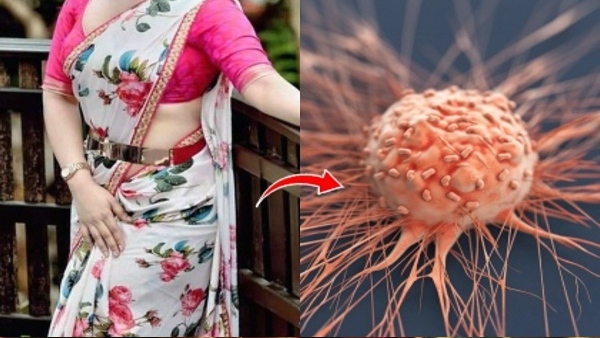 shocking news to women saree cancer chance who ties saree very tightly