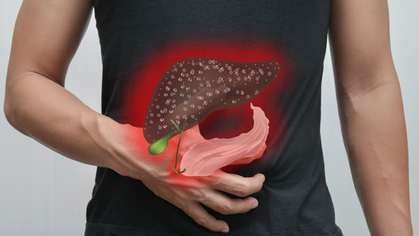 Surgery is not mandatory for Stones in Gallbladder