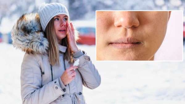 In this winter season Protect your skin from drying out follow these simple tips