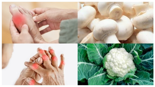 Vegetables that increase uric acid in the body Have you eaten too much of them