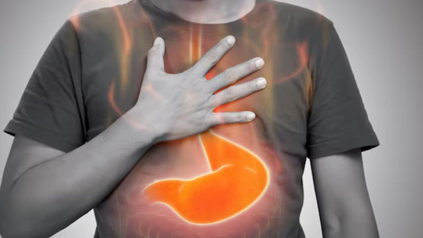 Are you suffering from acidity Try these home remedies