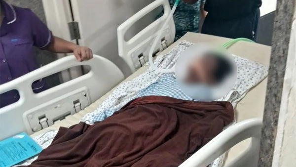 Sreetej s health is stable KIMS Hospital Health Bulletin