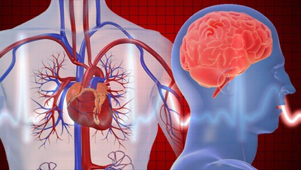 Is there a connection between brain stroke and heart attack How deadly are these