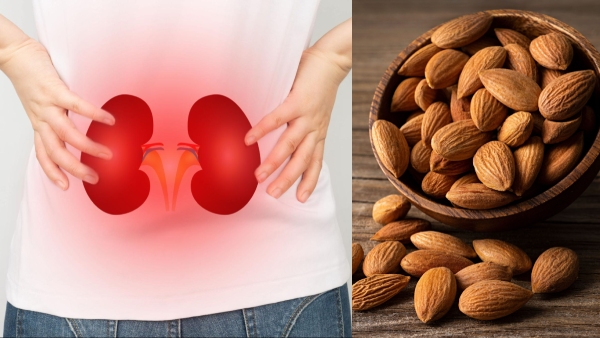 Health problems that can occur if people with kidney problems eat almonds