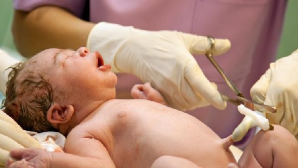 Why is the umbilical cord cut