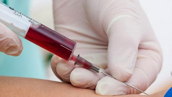 Do you know of a universal blood group It s very rare
