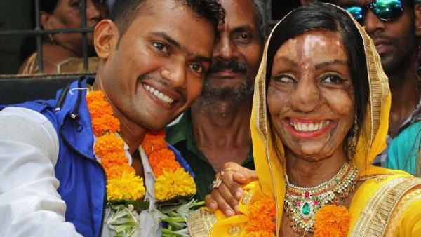 Emotional Lalita Bansi Shares Her Journey of Love and Survival After 17 Surgeries Emotional Lalita Bansi Shares Her Journey of Love and Survival After 17 Surgeries